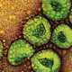 Image for article titled Are We At The Dawn Of The Age of Epidemics?